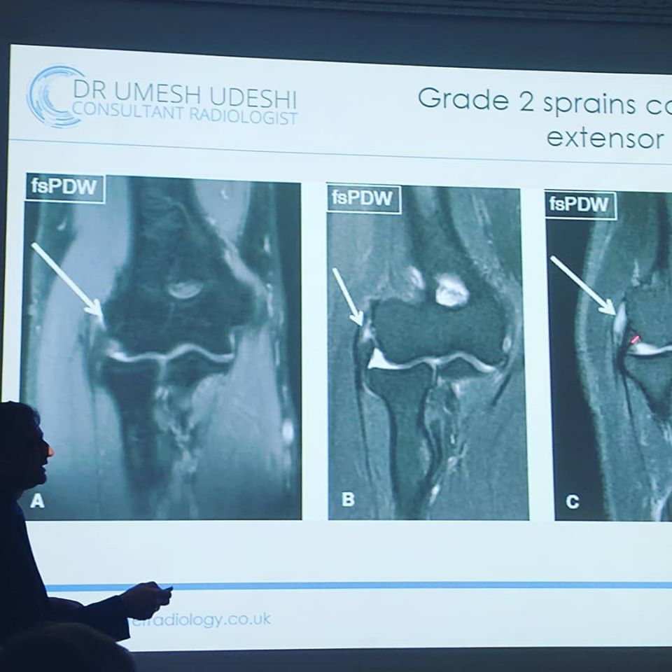 MRI Scan of Elbow Sprain - Umesh Udeshi, Cheltenham Cobalt Centre